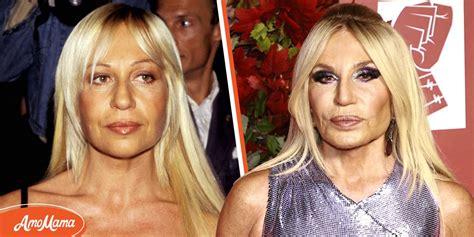 Experts Believe Donatella Versace Had Several .